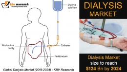 Dialysis Market size to reach $124 billion by 2024- KBV Research