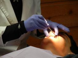 Reconstrucción dental completa: Proceso, beneficios y consideraciones